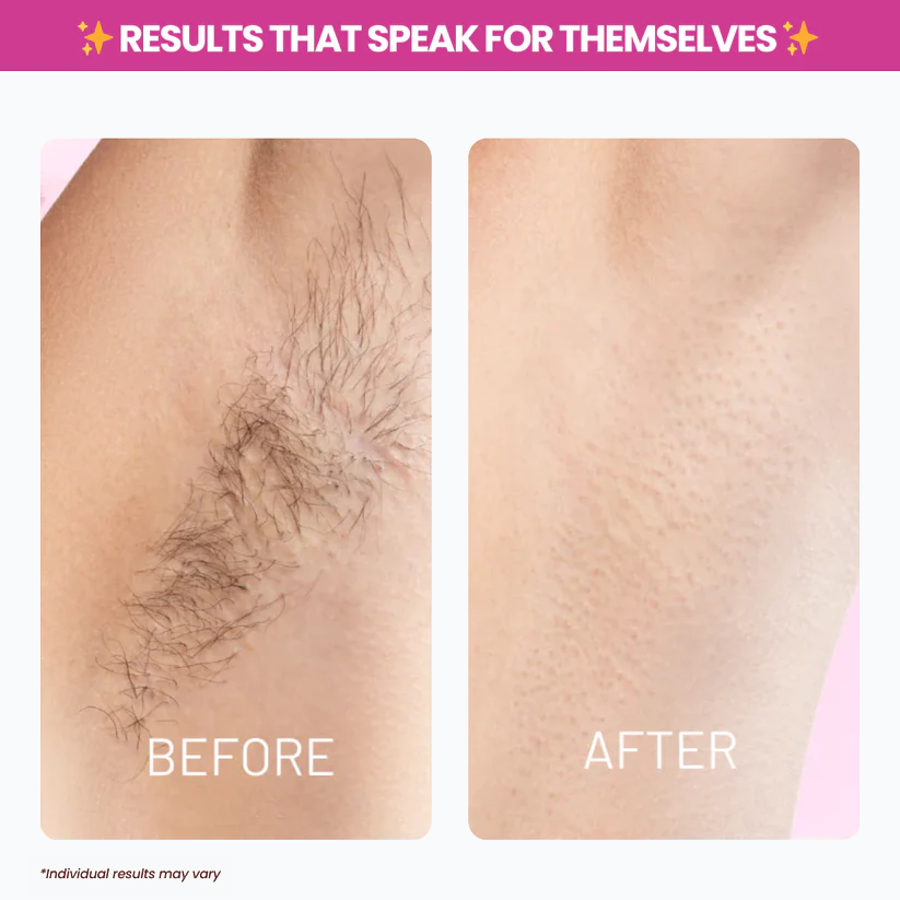 Viralona™ Cyperus Rotundus Oil