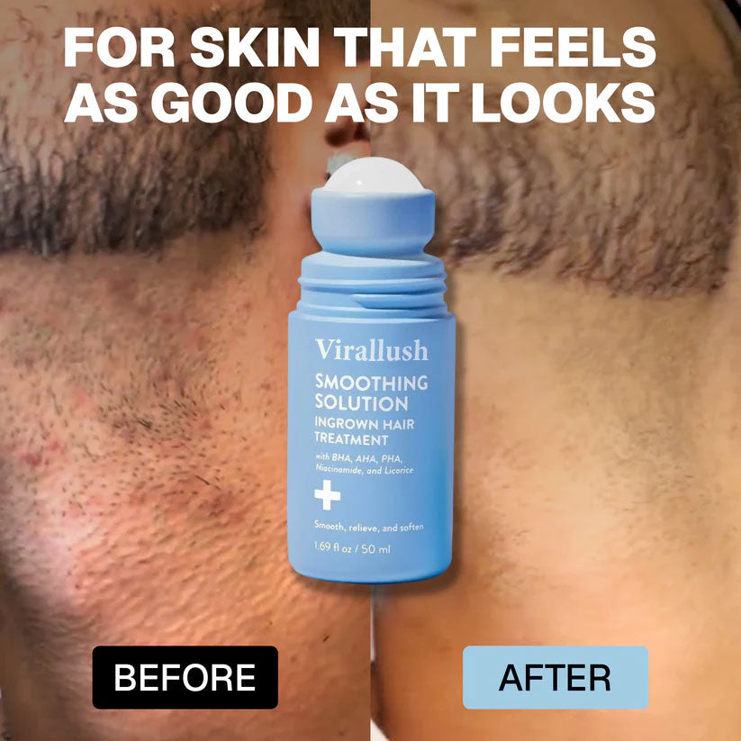 Viralona: Smoothing Solution For Ingrown Hairs