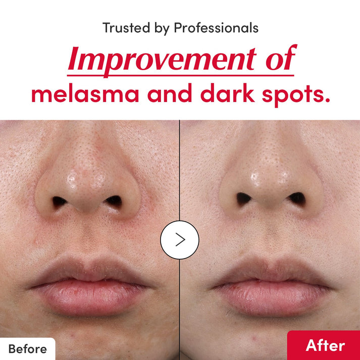 [#1 Solution for Dark Skin] Vitamin Illuminating Serum