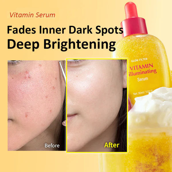 [#1 Solution for Dark Skin] Vitamin Illuminating Serum