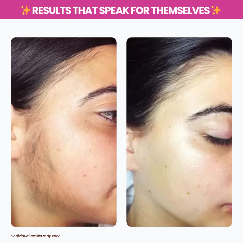 Viralona™ Cyperus Rotundus Oil