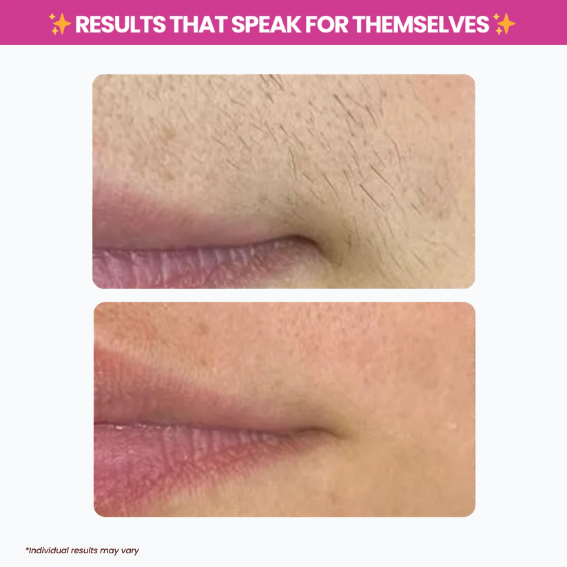 Viralona™ Cyperus Rotundus Oil