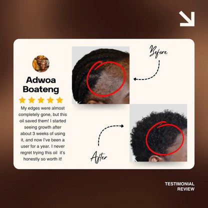 Batana Natural Hair Growth Oil 2.0