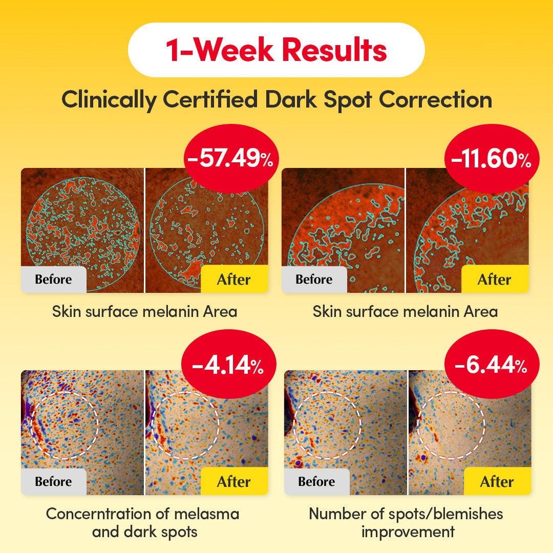 [#1 Solution for Dark Skin] Vitamin Illuminating Serum